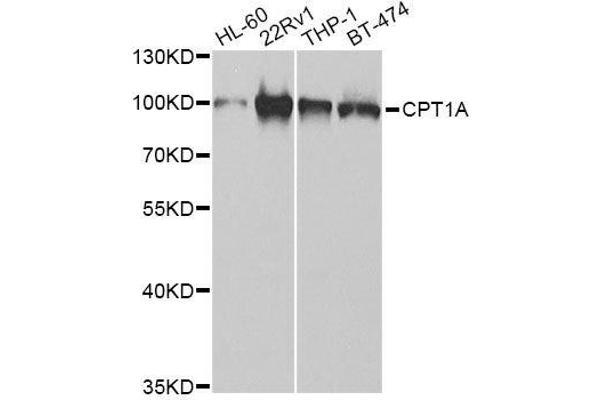 CPT1A antibody  (AA 497-756)