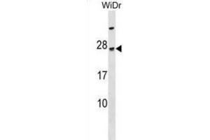 Western Blotting (WB) image for anti-TGFB-Induced Factor Homeobox 2-Like, Y-Linked (TGIF2LY) antibody (ABIN3000164)