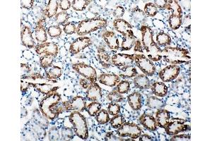 Immunohistochemistry (IHC) image for anti-Toll-Like Receptor Adaptor Molecule 2 (TICAM2) (C-Term) antibody (ABIN3029187)