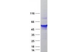 Western Blotting (WB) image for UDP-Glucuronate Decarboxylase 1 (UXS1) protein (Myc-DYKDDDDK Tag) (ABIN2735156)