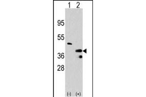 Western blot analysis of PRMT1 (arrow) using rabbit polyclonal PRMT1 Antibody (C-term) (R). (PRMT1 Antikörper  (C-Term))