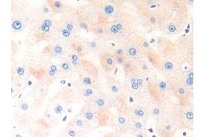 DAB staining on IHC-P; Samples: Human Liver Tissue (COL18 Antikörper  (AA 1572-1754))