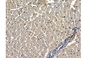 ABIN7097067 and ABIN7101134 at 1/100 staining rat heart tissue by IHC-P. (TMEM63C Antikörper)