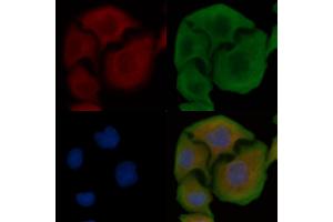 ABIN6258096 and ABIN6274395 staining Hela cells by IF/ICC. (RBM26 Antikörper  (Internal Region))
