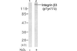 Image no. 2 for anti-Integrin beta 3 (ITGB3) (pTyr773) antibody (ABIN196720) (Integrin beta 3 Antikörper  (pTyr773))