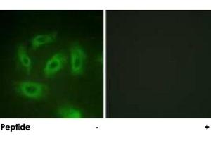 Immunofluorescence analysis of HeLa cells, using TGFBR1 polyclonal antibody . (TGFBR1 Antikörper  (Ser165))