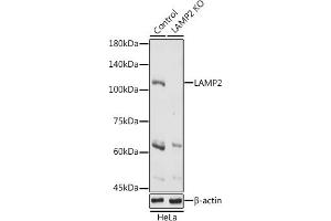 Western blot analysis of extracts of HeLa cells, using L antibody (ABIN6129969, ABIN6143081, ABIN6143082 and ABIN6218224) at 1:1000 dilution. (LAMP2 Antikörper  (AA 30-300))