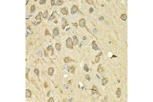 Immunohistochemistry of paraffin-embedded rat brain using IL10RA antibody at dilution of 1:200 (400x lens).