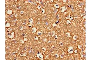 Immunohistochemistry (IHC) image for anti-ATPase, H+ Transporting, Lysosomal 13kDa, V1 Subunit G2 (ATP6V1G2) (AA 1-118) antibody (ABIN7175266)
