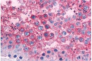 anti-Prion Protein (PRNP) antibody