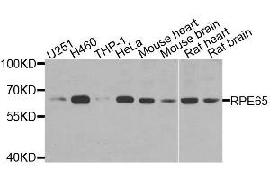 RPE65 Antikörper  (AA 274-533)
