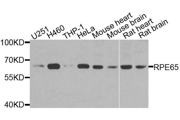 RPE65 Antikörper  (AA 274-533)
