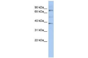 OAS2 antibody used at 1 ug/ml to detect target protein. (OAS2 Antikörper  (N-Term))