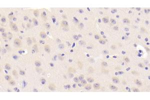 Detection of NEIL3 in Mouse Cerebrum Tissue using Polyclonal Antibody to Nei Endonuclease VIII Like Protein 3 (NEIL3) (NEIL3 Antikörper  (AA 2-187))