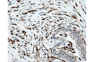 Immunohistochemical staining of paraffin-embedded Kidney tissue using anti-PLEK mouse monoclonal antibody. (Pleckstrin Antikörper)