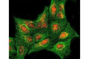 IF analysis of RASSF2 using anti-RASSF2 antibody (ABIN7599274) and anti-Tubulin Alpha antibody (ABIN7600339).