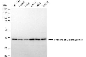 Western blotting analysis using phospho-eIF2 alpha (Ser51) antibody (ABIN7798512). (Rekombinanter EIF2A Antikörper  (pSer51))