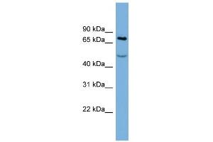 WB Suggested Anti-STIM1 Antibody Titration:  0. (STIM1 Antikörper  (Middle Region))