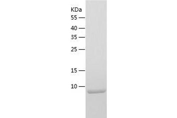 LBH Protein (AA 1-105) (His tag)