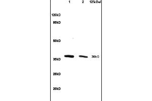 Lane 1: mouse liver lysates Lane 2: mouse intestine lysates probed with Anti HSD17B1/HSD17 Polyclonal Antibody, Unconjugated (ABIN718706) at 1:200 in 4 °C. (HSD17B1 Antikörper  (AA 21-120))