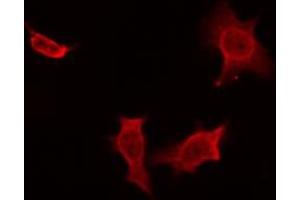 ABIN6274471 staining NIH-3T3 by IF/ICC. (MOBKL2A,B Antikörper)