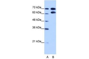 RAVER1 antibody used at 1. (RAVER1 Antikörper  (N-Term))