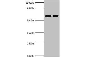 Western blot All lanes: N-acetylserotonin O-methyltransferase-like protein antibody at 2 μg/mL Lane 1: Hela whole cell lysate Lane 2: A549 whole cell lysate Secondary Goat polyclonal to rabbit IgG at 1/10000 dilution Predicted band size: 69, 68, 63 kDa Observed band size: 69 kDa (ASMTL Antikörper  (AA 1-290))