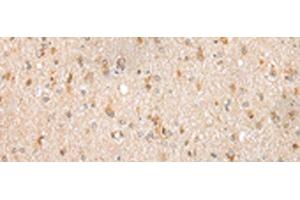 Immunohistochemistry of paraffin-embedded Human brain tissue using FKBP7 Polyclonal Antibody at dilution of 1:40(x200)