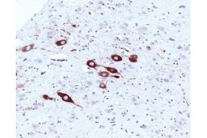 Immunohistochemical staining of a formalin-fixed paraffin-embedded rat brain tissue section with no pre-treatment (20X magnification). (NOS1 Antikörper  (AA 1095-1289))