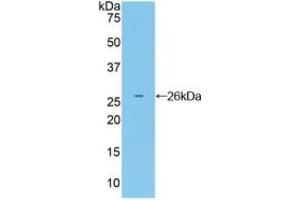 Western blot analysis of recombinant Mouse Grb7.