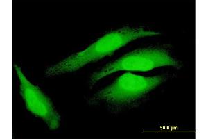 Immunofluorescence of purified MaxPab antibody to COPS8 on HeLa cell. (COPS8 Antikörper  (AA 1-209))