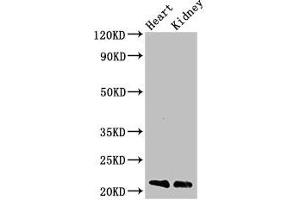 Western Blot Positive WB detected in: Mouse heart tissue, Mouse kidney tissue All lanes: SDC4 antibody at 3 μg/mL Secondary Goat polyclonal to rabbit IgG at 1/50000 dilution Predicted band size: 22, 17 kDa Observed band size: 22 kDa (SDC4 Antikörper  (AA 19-145))