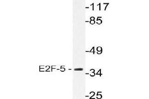 Western blot analysis of E2F5 Antibody in extracts from HeLa cells. (E2F5 Antikörper)