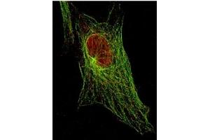 Immunofluorescence (IF) image for anti-Signal Transducer and Activator of Transcription 5A (STAT5A) (Tyr694) antibody (ABIN400812) (STAT5A Antikörper  (Tyr694))
