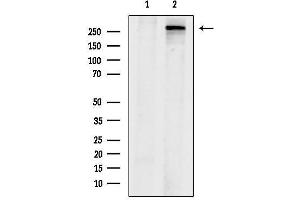 anti-Acetyl-CoA Carboxylase alpha (ACACA) (N-Term) antibody