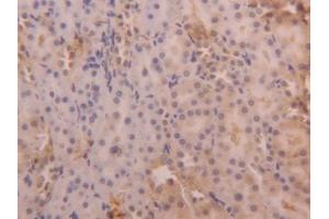 DAB staining on IHC-P; Samples: Rat Kidney Tissue (SERPINA6 Antikörper  (AA 173-344))