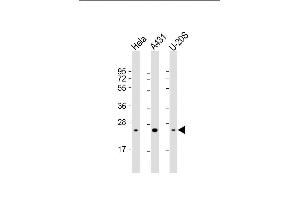 Lane 1: HeLa Cell lysates, Lane 2: A431 Cell lysates, Lane 3: U-20S Cell lysates, probed with RAB1B (1673CT667. (RAB1B Antikörper)