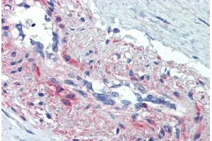 Human Vessel, Smooth Muscle (formalin-fixed, paraffin-embedded) stained with SSX4 antibody ABIN462200 followed by biotinylated goat anti-rabbit IgG secondary antibody ABIN481713, alkaline phosphatase-streptavidin and chromogen. (SSX4 Antikörper  (AA 108-157))