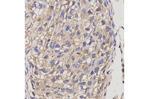 Immunohistochemistry (IHC) image for anti-ATP-Binding Cassette, Sub-Family A (ABC1), Member 6 (ABCA6) antibody (ABIN1870712) (ABCA6 Antikörper)