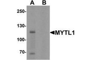 Western blot analysis of MYT1L in mouse brain tissue lysate with MYT1L Antibody  at 1 μg/mL in (A) the absence and (B) the presence of blocking peptide. (MYT1L Antikörper  (C-Term))
