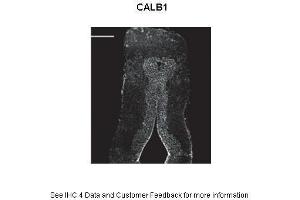 Primary Antibody Dilution: 1:500Secondary Antibody: Donkey anti-rabbit Alexa 488 Secondary Antibody Dilution: 1:000  Gene Name: CALB1 Submitted by: Anonymous