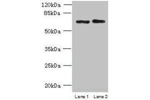 Western blot All lanes: TBC1D19 antibody at 9 μg/mL Lane 1: U251 whole cell lysate Lane 2: A375 whole cell lysate Secondary Goat polyclonal to rabbit IgG at 1/10000 dilution Predicted band size: 61, 53 kDa Observed band size: 61 kDa (TBC1D19 Antikörper  (AA 1-300))