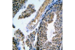 Immunohistochemical analysis of FSHR staining in human testis formalin fixed paraffin embedded tissue section. (FSHR Antikörper  (Center))