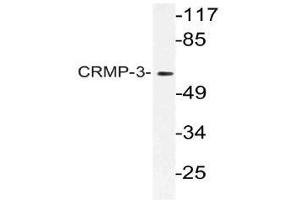 Western blot (WB) analysis of CRMP-3 antibody in extracts from HT-29 cells. (DPYSL4 Antikörper)