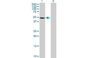 Western Blot analysis of SEMG1 expression in transfected 293T cell line by SEMG1 MaxPab polyclonal antibody. (SEMG1 Antikörper  (AA 1-402))
