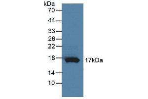 Figure. (RNASE4 Antikörper  (AA 30-147))