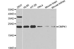 Western blot analysis of extracts of various cell lines, using CMPK1 antibody. (Cytidine Monophosphate (UMP-CMP) Kinase 1, Cytosolic (CMPK1) Antikörper)
