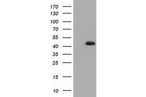 HEK293T cells were transfected with the pCMV6-ENTRY control (Left lane) or pCMV6-ENTRY HIBCH (Right lane) cDNA for 48 hrs and lysed. (HIBCH Antikörper)