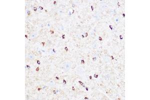 Immunohistochemistry of paraffin-embedded Mouse brain using CD47 antibody (ABIN6127604, ABIN6138199, ABIN6138201 and ABIN6223104) at dilution of 1:100 (40x lens). (CD47 Antikörper  (AA 20-140))