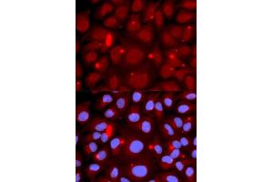 Immunofluorescence analysis of U2OS cells using PADI4 antibody (ABIN5970978). (PAD4 Antikörper)